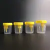 Copo de urina com pressão negativa a vácuo 60/80/90/100/120ml coletor de urina copo de amostra de sucção automática copo de coleta de amostra