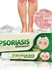 Comercio exterior transfronterizo Amazon AliExpress crema antibacteriana de hierbas a musgo para el cuidado de la piel antipruriginosa