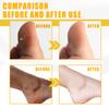 Ouhoe Aceite Exfoliante Amarillo Suave Nutritivo Hidratante Cuidado de la Piel Piel del Cuerpo Hidratación Limpieza Blanqueamiento Tono de Piel Suave