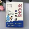 Sangria para curar doenças um livro de texto de acupuntura e moxabustão sangria popular chinesa livros de acupuntura e moxabustão