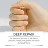 Solução Laniska para Cuidado das Unhas Cuida Suavemente e Suaviza a Superfície da Unha, Deixando-a Brilhante, para o Cuidado Diário das Unhas das Mãos e dos Pés