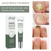 Creme para Cuidado das Unhas Eelhoe Solução para Problemas nas Unhas Cuidado para Mãos e Pés Espessamento Limpeza e Suavização de Problemas nas Unhas Creme para Unhas