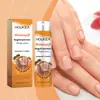 Houkea Spray para el Cuidado de las Uñas con Veneno de Abeja Limpieza Diaria de Uñas Brillo Natural Spray Nutritivo Suave
