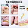 Líquido Antibacteriano para Fungo de Unha Cinza, Cuidados para Pés Impatiens, Óleo Essencial para Remoção de Unha, Creme para Remoção de Unha, Atacado do Fabricante