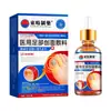Solução Médica para Onicomicose, Líquido Antibacteriano, Creme para Remoção de Unhas, Espessamento de Unhas Amareladas, Unhas Quebradiças, Solução para Onicomicose, Solução de Cuidado para Superfície de Unhas Quebradiças e Rachadas