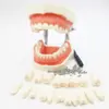 Modelo de Práctica para Preparación Dental Removible con Ejercicio Gingival, Modelo de Diente con Resina de Encía Suave, Incluye Cuchillo