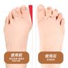 Chanclas de Tres Orificios, Chanclas, Separadores de Dedos, Pantuflas, Sandalias, Chanclas, Almohadillas Gruesas para Pies, Separadores Masajeadores Amortiguadores