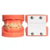 Modelo de Dente Dental, Modelo de Demonstração de Correção de Má Oclusão, Modelo de Ensino para Correção com Modelo de Bracket Adesivo para Prática Odontológica