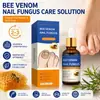 BEEVENOMNAIL FUNGUS Líquido para Cuidados com as Unhas Exportação Transfronteiriça Versão em Inglês Atacado de Peça Única Transfronteiriço