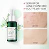 FENYI FENYI Árbol de Té Esencia Anti-acné 17ml Esencia Esencia Facial Hidratante Productos para el Cuidado de la Piel