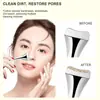 Set de dos piezas de Aguja para Acné y Pala para Puntos Negros de Acero Inoxidable del Fabricante, Herramienta de Belleza para Eliminación de Puntos Negros y Acné, Se Puede Usar como Barra para Crema Facial