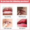 EELHOE Labial Hidratante Iluminador Anti-grietas Cuidado de la Piel de los Labios Nutritivo Hidratante Desalinización Línea de Labios Bálsamo Labial