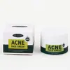 Crema para el Acné con Ácido Salicílico Transfronteriza Crema Facial para el Acné Desvanece Marcas de Acné, Crema para el Acné, Crema Control de Grasa, Inglés Completo