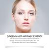 Esencia Reafirmante de Ginseng Hoygi Atenúa Líneas Finas Líneas de Expresión Nutritiva Suave Reafirmante Esencia para el Cuidado de la Piel