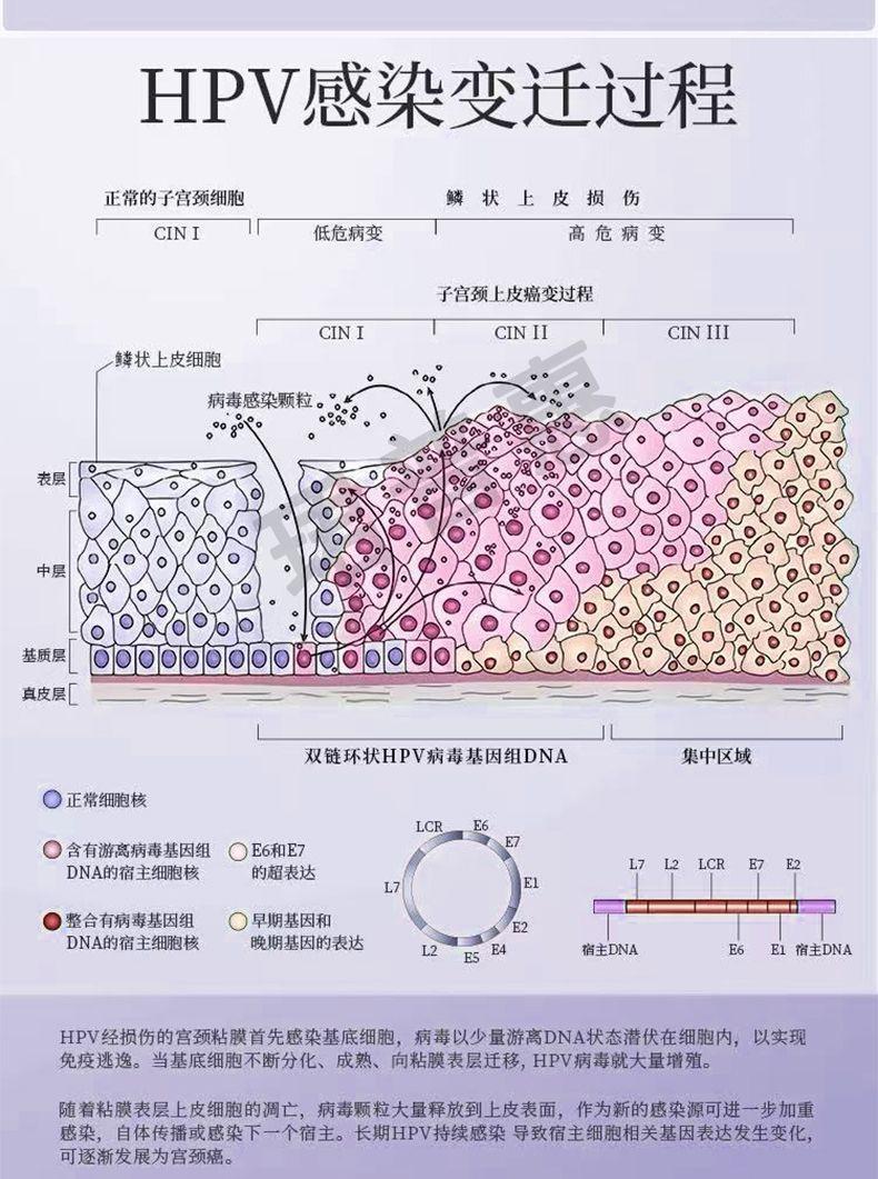 珺普惠医用抗HPV生物蛋白功能敷料病毒干扰素凝胶降低载量妇科阴