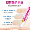 Gel de Silicona Médica para Cicatrices Mejora las Cicatrices Causadas por Quemaduras, Escaldaduras, Traumatismos, Traumatismos Superficiales, Cirugías y Otras Razones