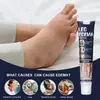Sumifun Creme Transfronteiriço para Edema, Creme para Drenagem e Cuidados com a Saúde, Shopee Lazada Comércio Exterior Inchaço nas Pernas Massagem K10282