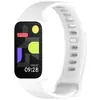 Adequado para Pulseira Redmi 3, Pulseira Xiaomi 9 Active Pulseira Oficial de Qualidade do Mesmo Tipo