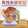 Modelo Anatómico Sagital Medio de Pelvis Masculina Pequeña Anatomía del Sistema Reproductor Masculino Modelo de Enseñanza Médica