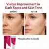 Crema Facial Sauvasine 7% Arbutina + 4% Ácido Tranexámico Transfronteriza 50ml