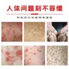 Pomada Zou Run'An para Alivio de la Picazón en la Piel para Ampollas y Descamación, Crema Antibacteriana, Popular en Comercio Electrónico de Transmisión en Vivo, Dropshipping
