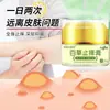 [Personalizable] Crema Anti-Picazón Baicao, Crema Antibacteriana para la Piel, Pomada para la Picazón de la Piel, Crema Anti-Picazón y Antibacteriana