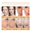 West&Month Esencia Facial de Cúrcuma Hidratante Suave Humectante Suavizante Iluminador Nutritiva Esencia para la Piel Facial