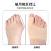 Órtesis para dedos superpuestos del dedo gordo del pie, separador de hallux valgus, órtesis para dedos del dedo gordo del pie, separador de dedos
