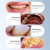 Escova de dentes elétrica inteligente multifuncional para casa 2 em 1 limpador dental, limpador de dentes, removedor de tártaro, dispositivo elétrico para beleza dos dentes