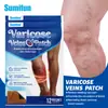 Adesivo Sumifun Transfronteiriço para Alívio e Cuidados com as Pernas para Aliviar Dores e Inchaço nas Panturrilhas, Varizes e Desconforto nas Pernas K000148