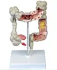 Modelo Muscular de la Pared de la Garganta, Material de PVC, Modelo de Anatomía del Sistema Digestivo