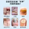 Creme Clareador para Fungos nas Unhas Creme de Limpeza Herbal para Salões de Pedicure para Remover Unhas Danificadas e Grossas, Fungos nas Unhas dos Pés e Creme para Cuidados com os Pés