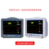 Monitor Multiparamétrico Portátil Electrocardiograma Frecuencia Cardíaca Signos Vitales Monitor Multilead Modelo Multifuncional Médico Comercio Exterior