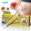 Sumifun Gesso Transfronteiriço da Amazon Comércio Exterior Creme para Contusões Creme para Cuidados com Lesões Esportivas e Fitness K10133 À Prova d'Água