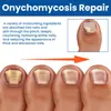 Parches para el Cuidado de las Uñas Ximonth para Manos y Pies, Uñas Suaves y Lisas, Limpias y Cómodas, Frescos y Transpirables, Parches que se Ajustan y Cuidan
