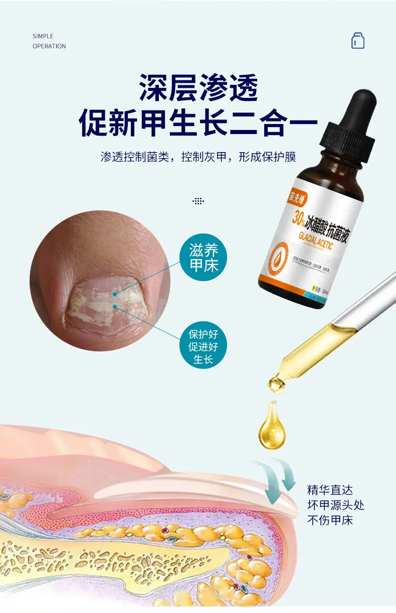 30%冰醋酸抗菌液详情_07.jpg